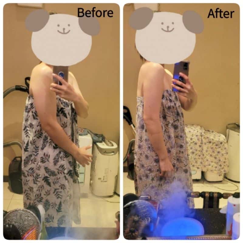 [강동] 부은얼굴과 몸을 명품몸매와 동안얼굴로! 사진 4